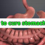 How To Cure Stomach Gas