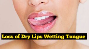 सूखे होठों को जीभ से गिला करने के नुकसान || Loss of Dry Lips Wetting Tongue || Lips Tricks And Tips Healthadda24